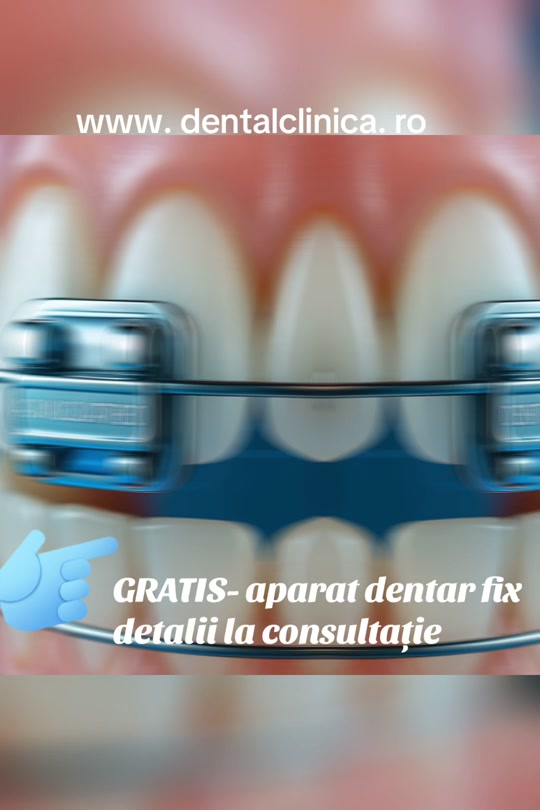 #beauty #fy #fyp #dentist #sanatate 