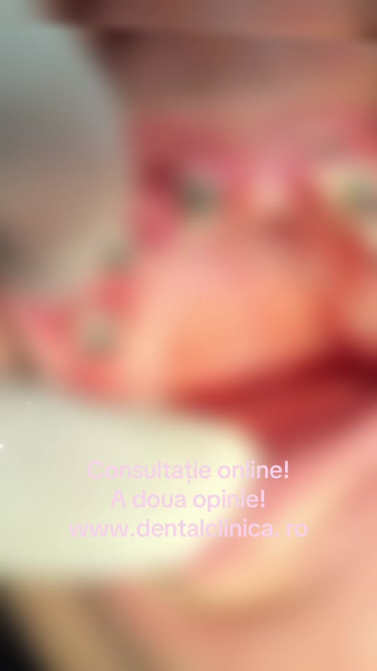 #fyp #fy #trend #beauty #crypto 